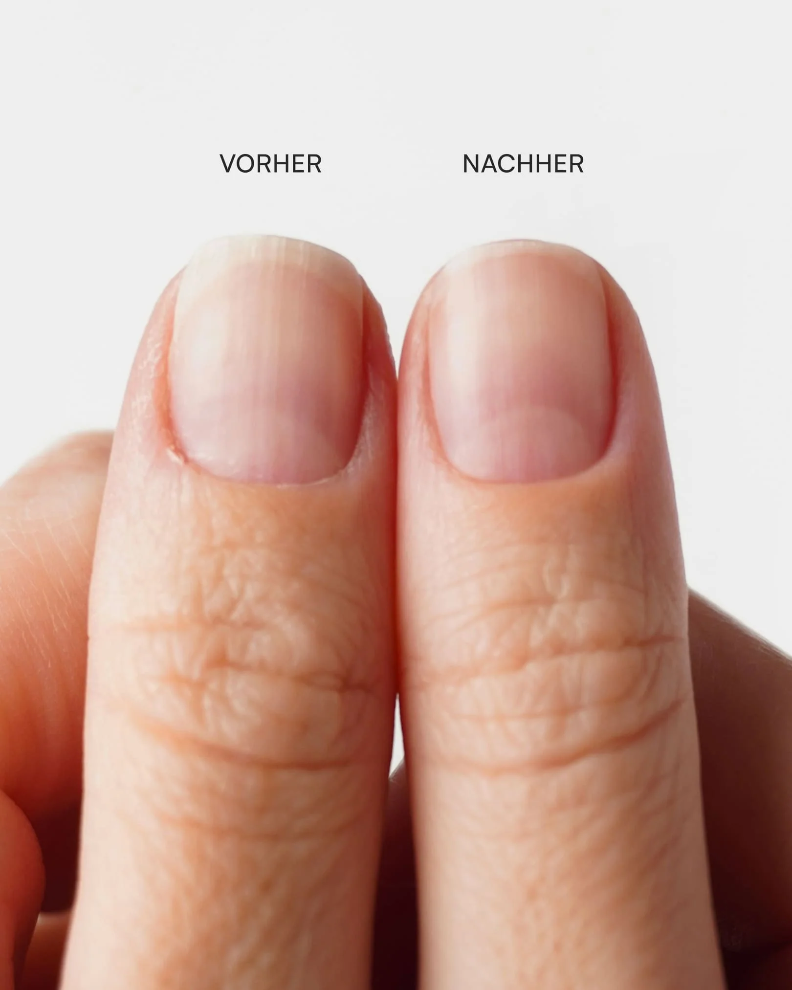 Nagelhautzange 5 Nagelhautzange